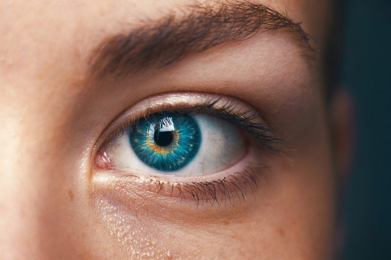 Strabismus